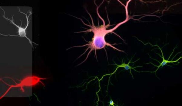 内皮细胞培养基质量实验的影响有哪些