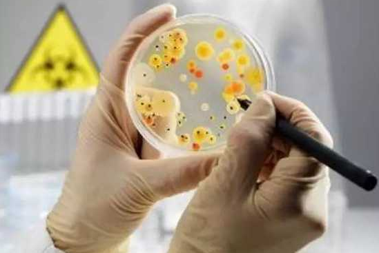 专业微生物多样性检测的优势有哪些 专业微生物多样性检测的优势有哪些